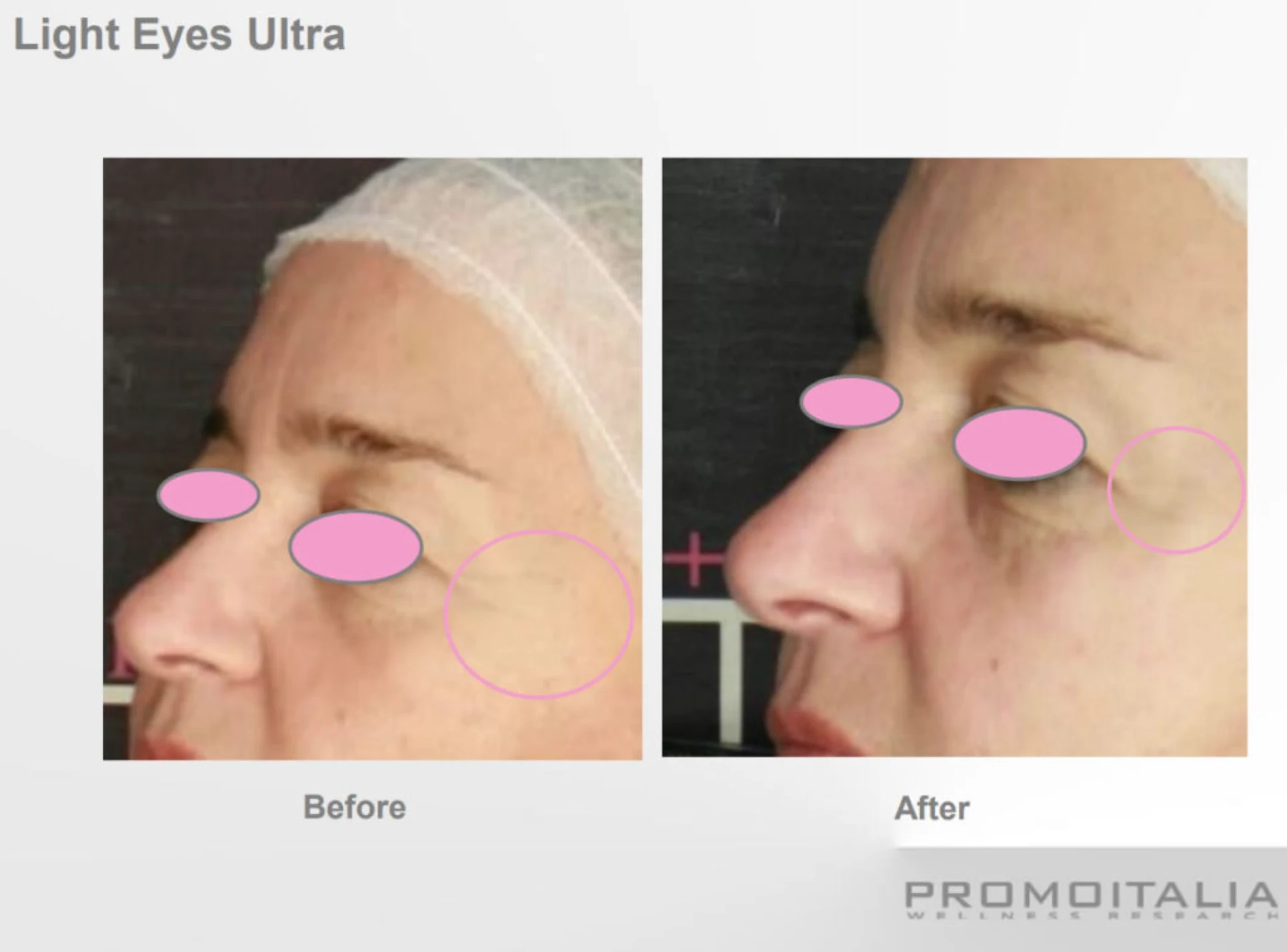 Cosmetic Procedures Park City