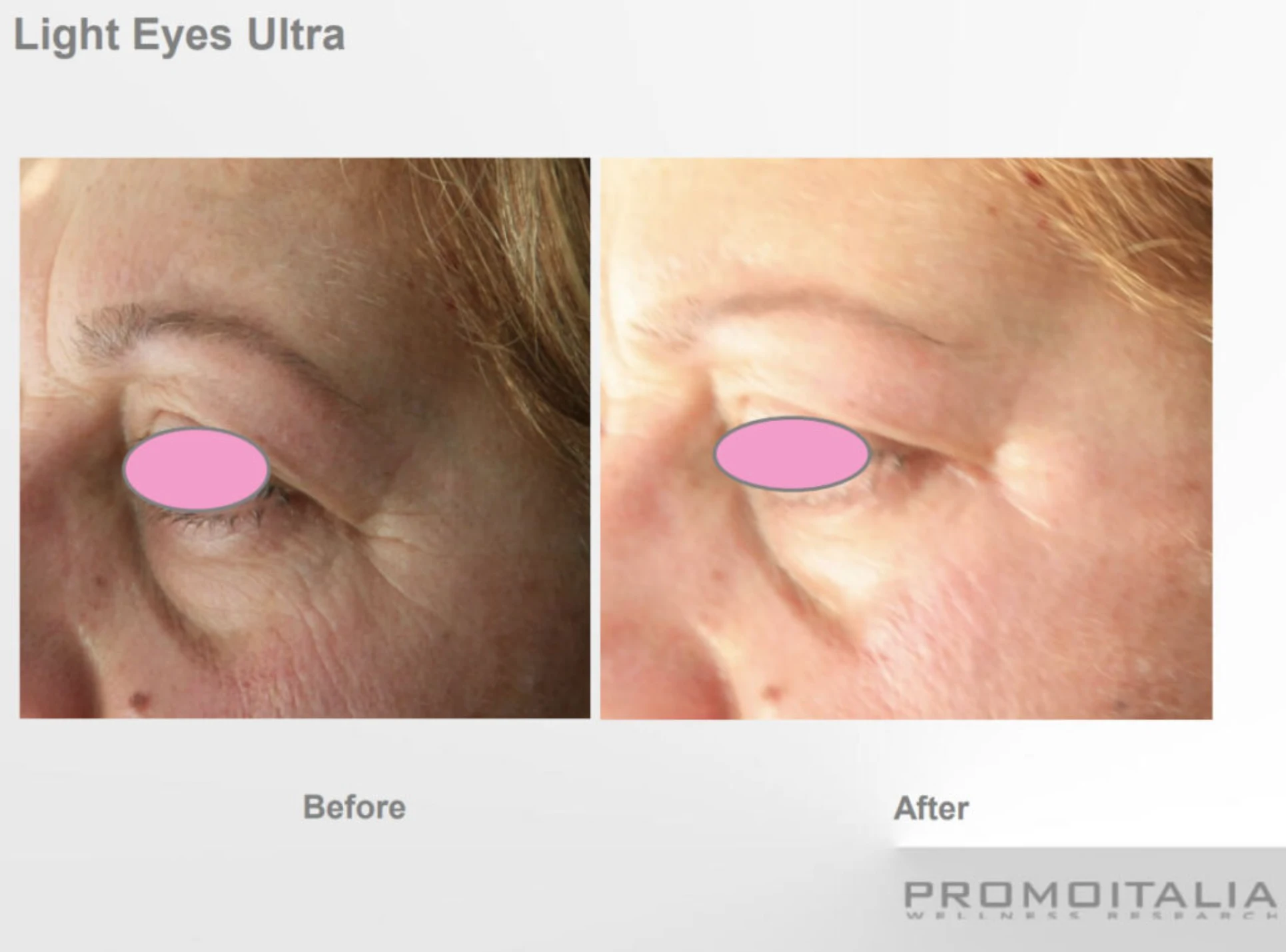 Cosmetic Procedures Park City