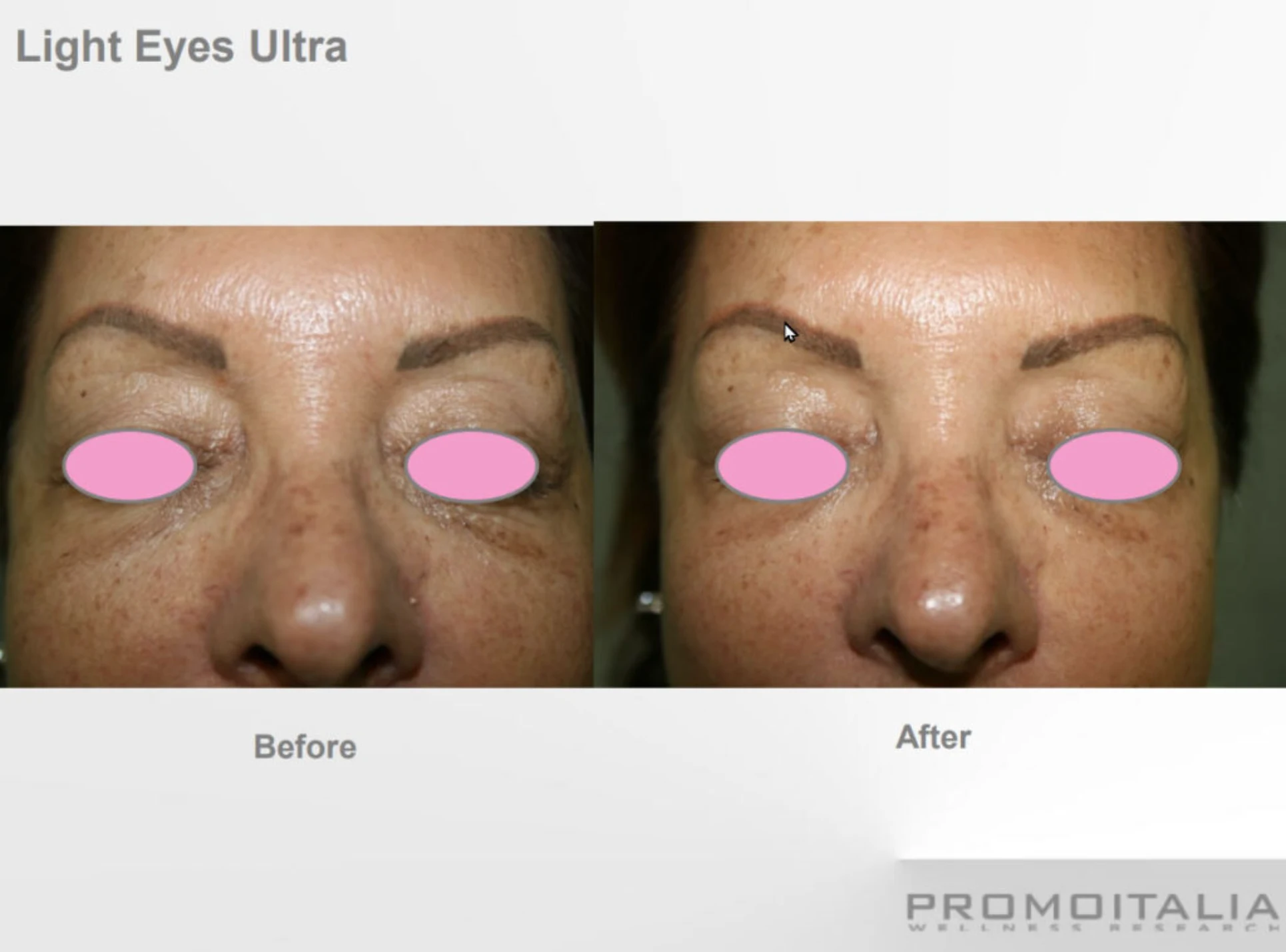 Cosmetic Procedures Park City