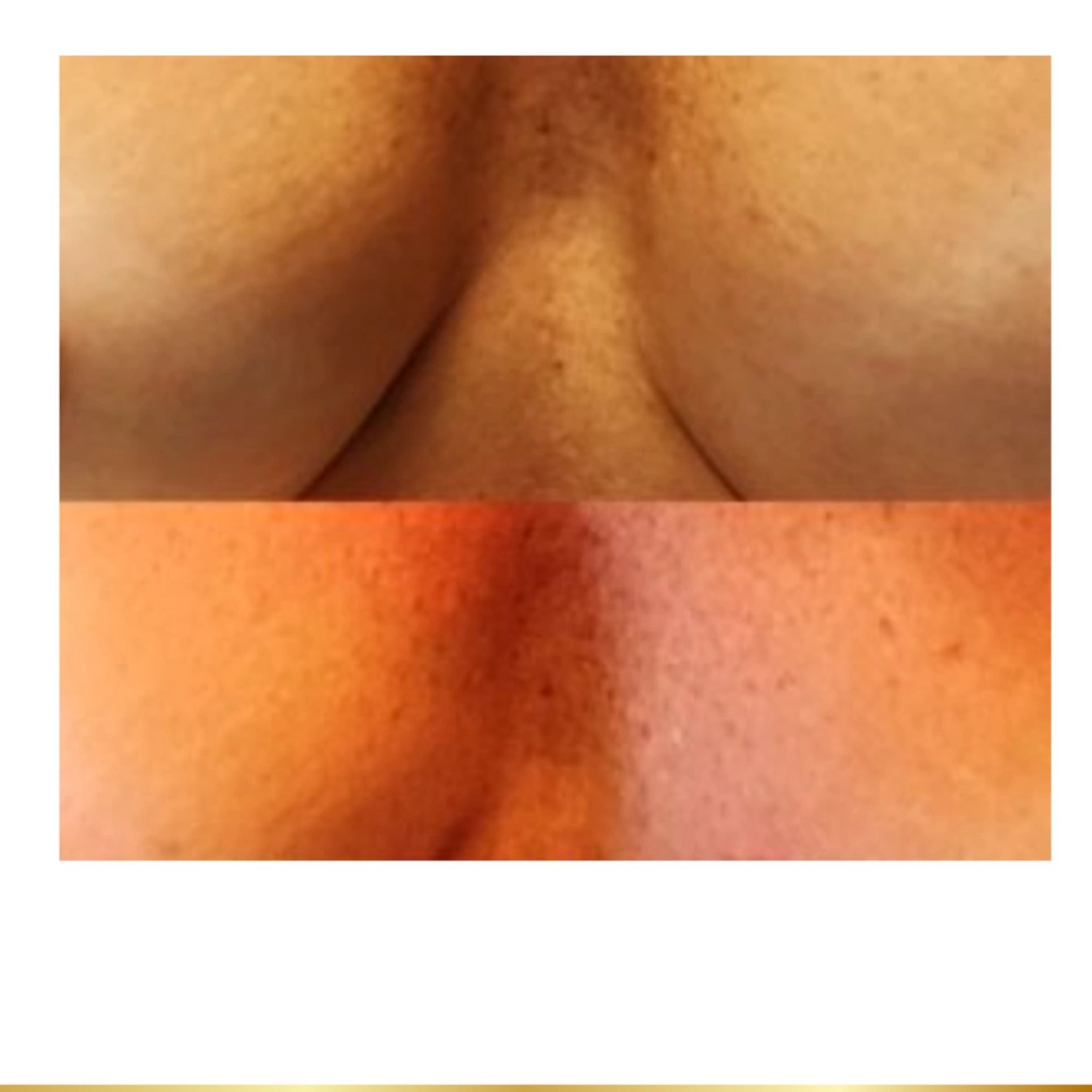 Before and after pigmentation treatment showing improved skin tone and brightness.